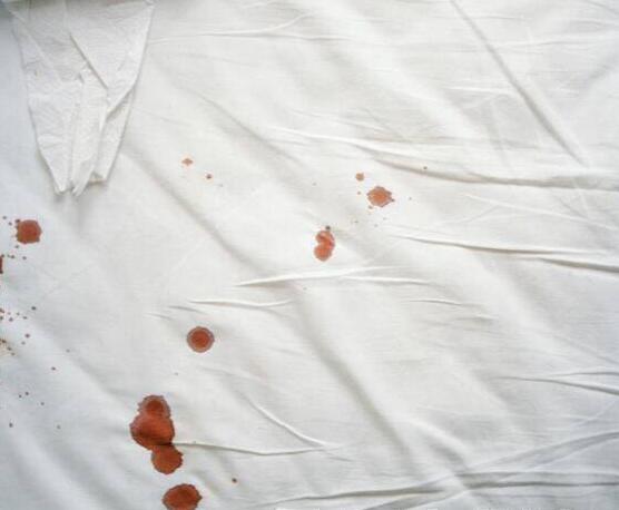 白大褂剛沾染血漬時